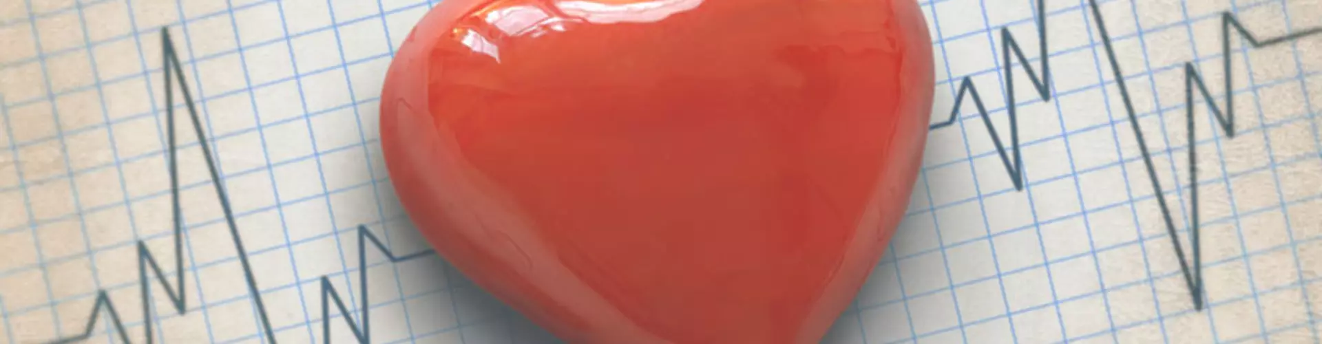 How to Become a Cardiovascular Technologist How to Become a Cardiovascular Technologist